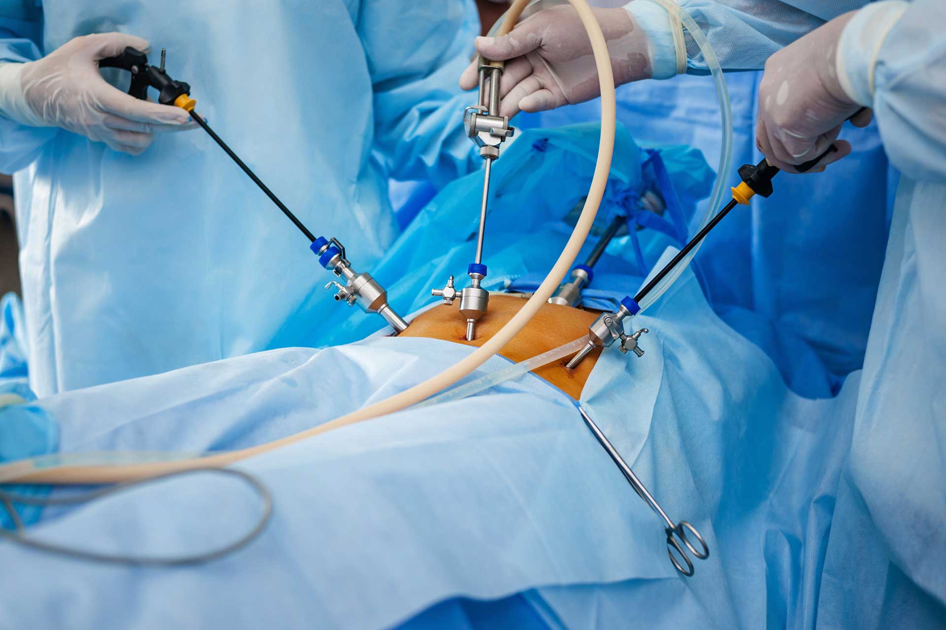 چه عملهایی در رشته اورولوژی یا جراحی کلیه و مجاری ادراری با لاپاراسکوپی انجام می شود؟