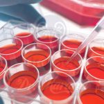 جوان سازی تخمدان زنان با استفاده از سلول‌های بنیادی خون قاعدگی