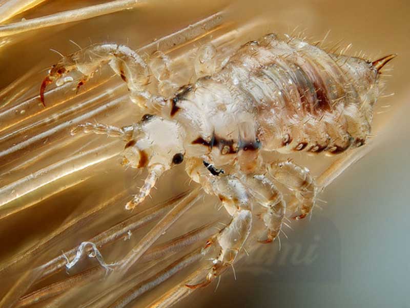 شپش ناحیه تناسلی (Pubic lice (‘crabs’))