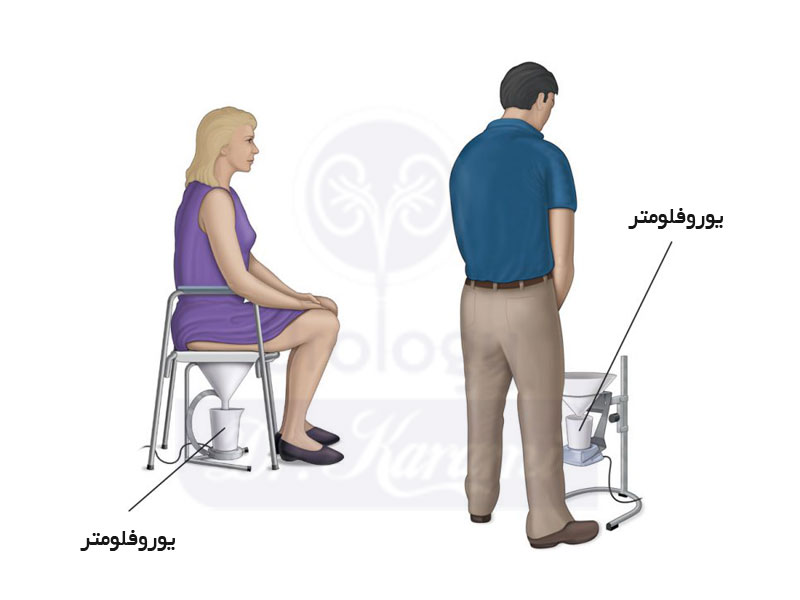 تست یورودینامیک