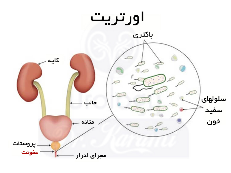 شماتیک اورتریت