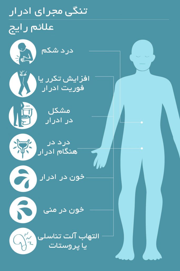 تنگی مجرای ادرار