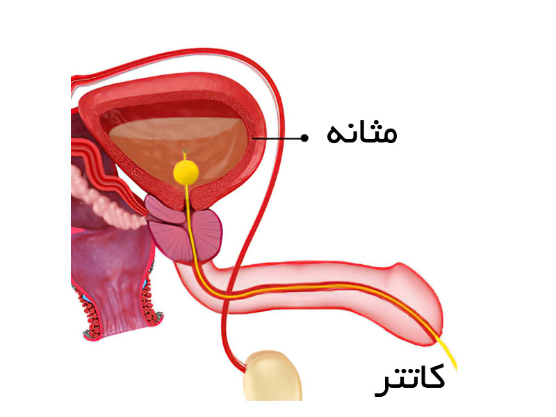 سیستومتری