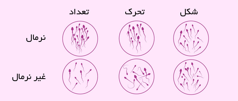 نتایج تحلیل مایع منی