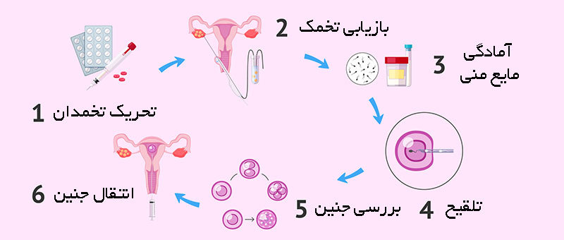 مراحل انجام IVF