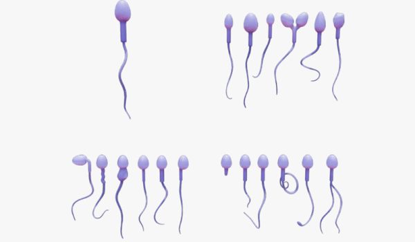 موفولوژی اسپرم چیست؟