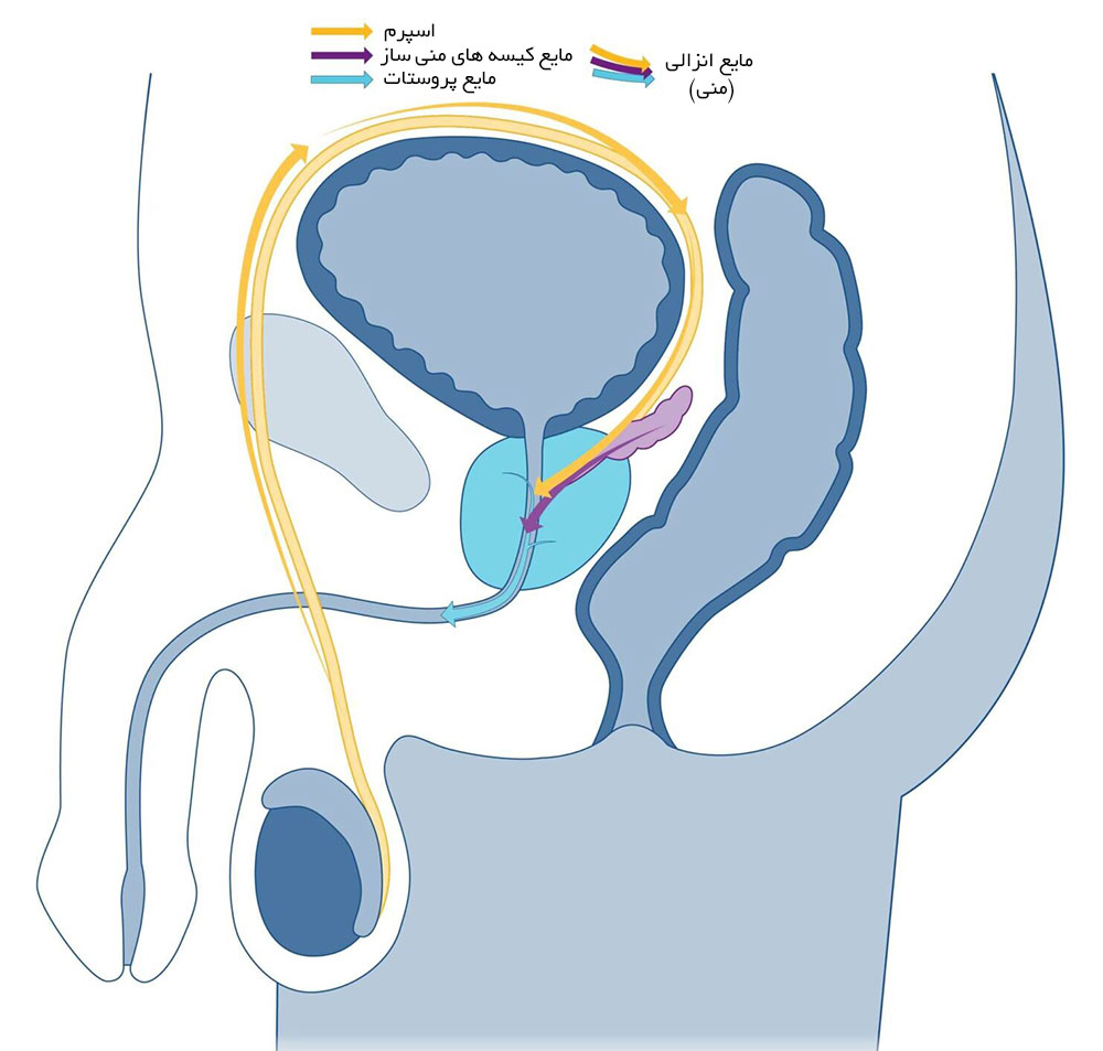 آزاد شدن مایع پروستات