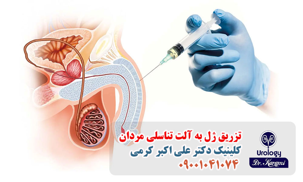 افزایش قطر آلت تناسلی با تزریق ژل چیست؟